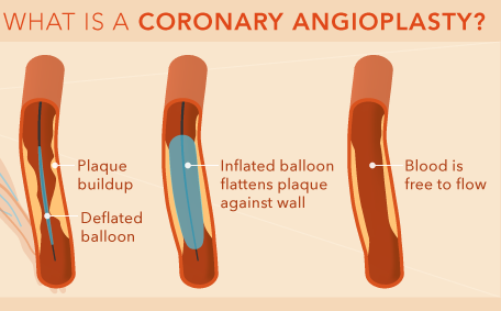 Cardiologist In Nashik